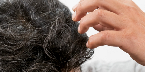 発毛剤で生えた髪はやめても維持される？