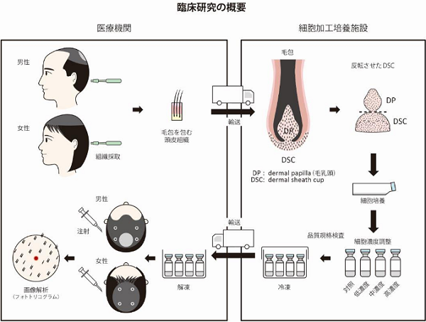 東京医科大と資生堂の毛髪再生医療臨床試験